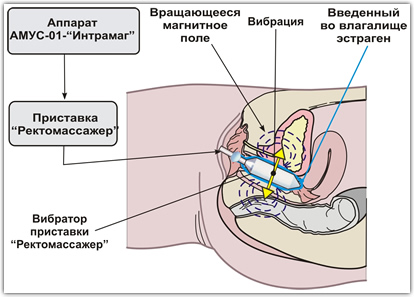 А ну-ка, удиви меня!