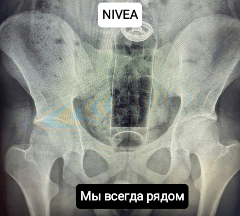 — Дорогой, где ты был? — Бегал...