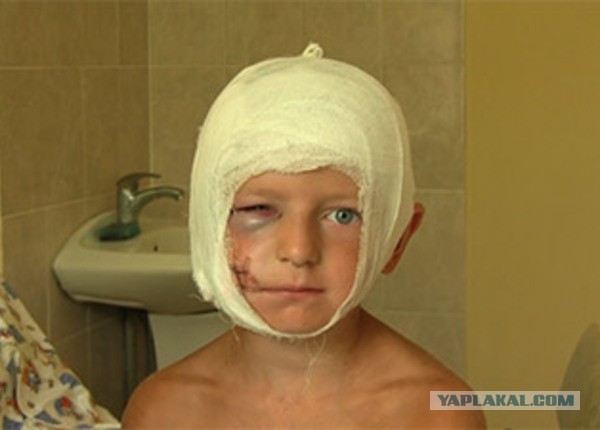 Стая собак напала на мужчину с ребенком