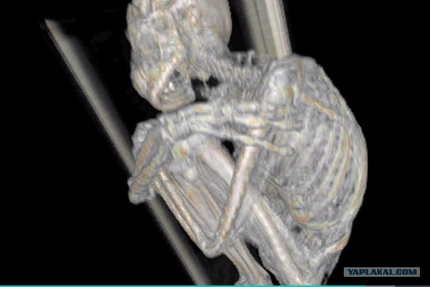 В Перу найдена мумия инопланетянина