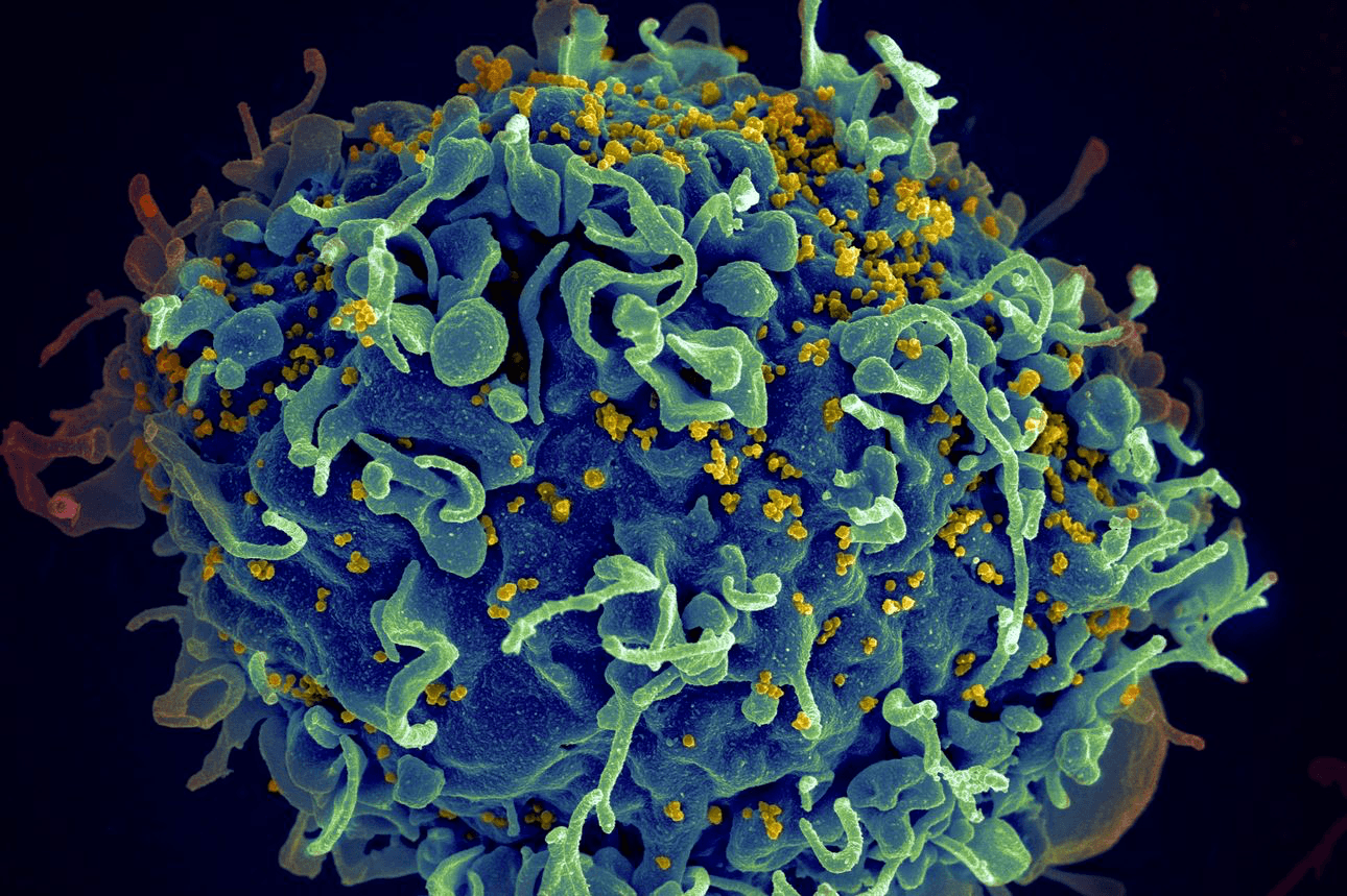 Вирус ВИЧ под микроскопом. Т-лимфоциты ВИЧ микроскоп. Вирус иммунодефицита человека (Human Immunodeficiency virus). HIV вирус.
