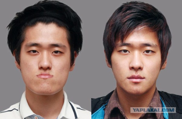 Южные корейцы до и после пластической операции