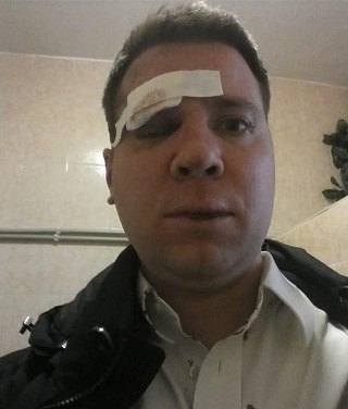 Беркут растрощил водителю автомобиль.