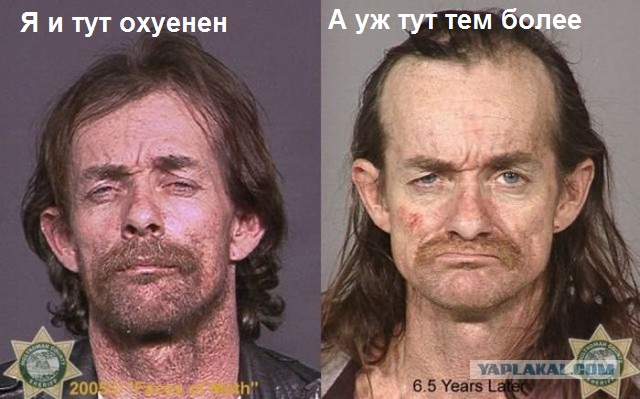 Наркоманы до и после