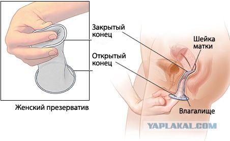 Алименты на миллион