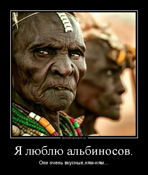 Танзанийские альбиносы, чьи тела стоят дороже