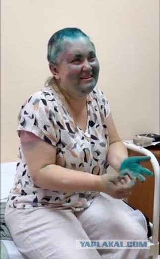 Нападение на журналистку Милашину: способно ли государство защитить Право