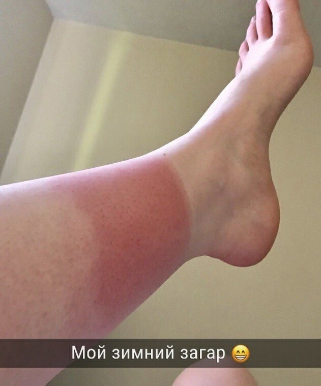 Понимаю: мода, молодёжь, но рукалицо!