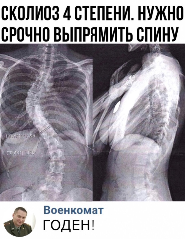 Картинки для деградации 16 (разной степени свежести)