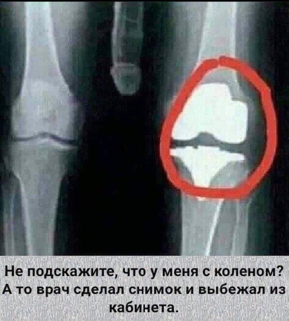 Есть подозрения