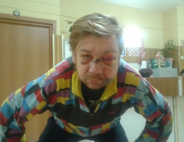 Гришковец рассказал о предательстве Шнурова