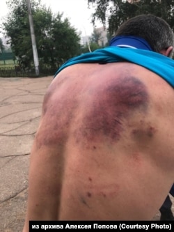 Росгвардейцы несколько часов избивали спасателя МЧС и угрожали его изнасиловать