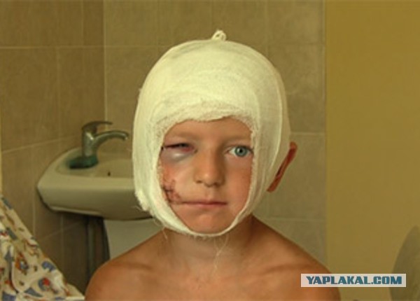 Догхантеры начали травить собак в Ижевске.