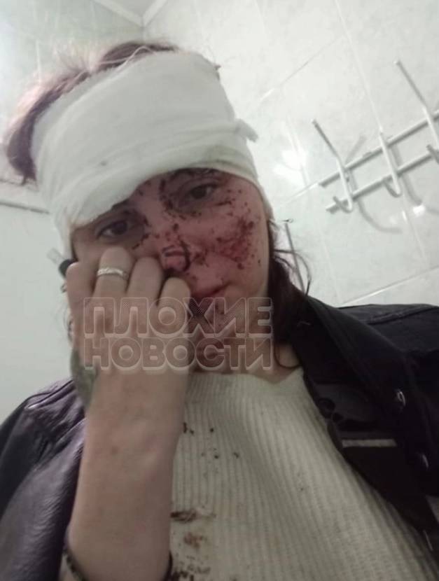 Во Владимире многодетная наркоманка вылетела на встречку и врезалась в другое авто: 8 пострадавших, четверо из них дети