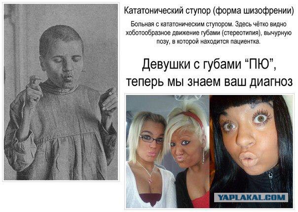 Фобии