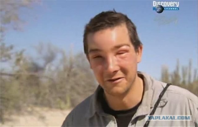 Слишком поздно заметил комара на щеке