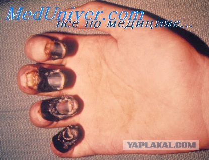 Пострадал, причиняя добро и пользу нанося