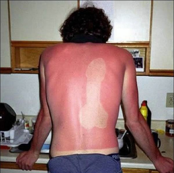 Клеймо загаром.