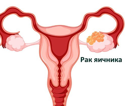 Знаменитое фото: Семья встречает пилота из плена - неожиданная история