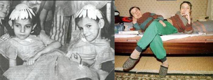 Сёстры кривошляповы сиамские близнецы. Дашу и машу кривошляповых. Дашу и машу кривошляповых. Сёстры кривошляповы сиамские близнецы. Сёстры кривошляповы 2003.