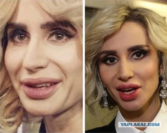 Тилль Линдеманн забрал Светлану Лободу из больницы