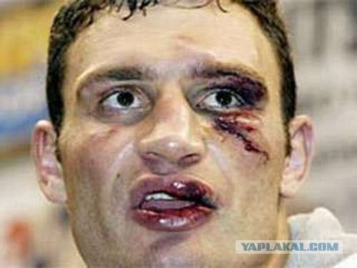 Виталий Кличко