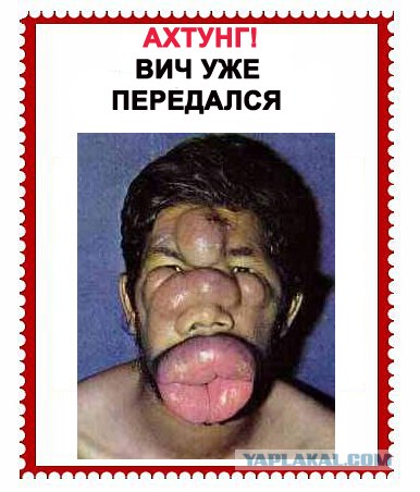 ВИЧ не передается...