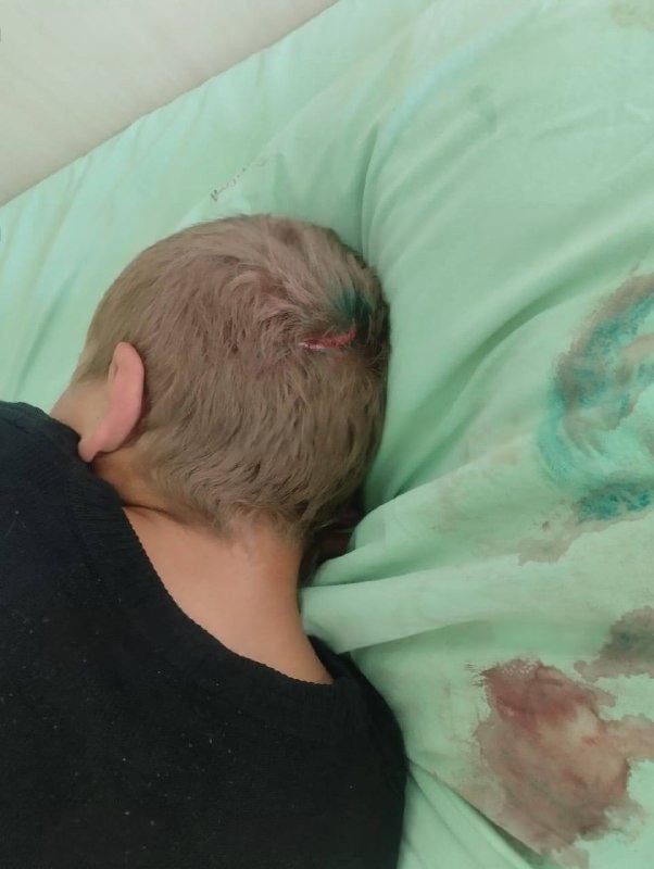 "— Тебя бьют? Бьют здесь?— Да!— Смотрите, это у него цепь такая"