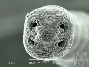 Красноярские хирурги достали из печени мужчины огромного червя