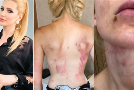 Спортсменку, нанесшую телесные повреждения двум кавказцам, взяли под стражу