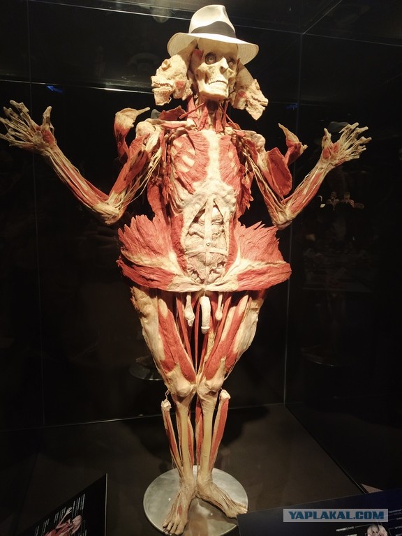 Посетил выставку Body Worlds на ВДНХ
