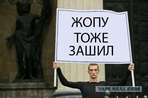 Жертва инъекций бетона показала новое лицо