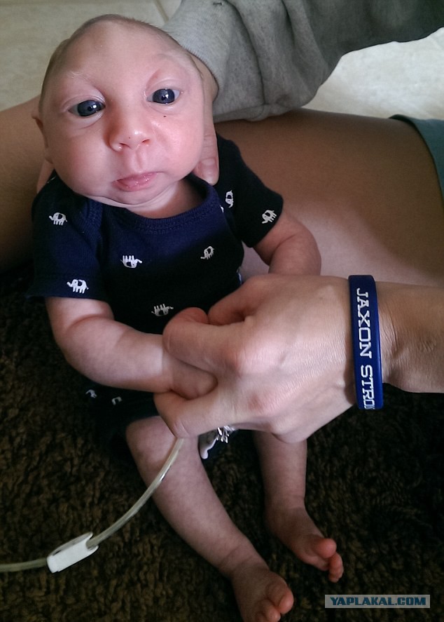 Ребенок без большей части головы отпраздновал свой