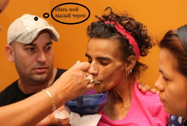 18-летняя девушка впала в кому после операции