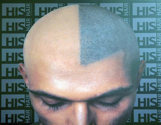 Вместо лысины - татуировка