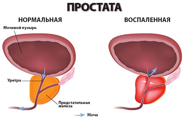 20 фото для восстановления нервных клеток