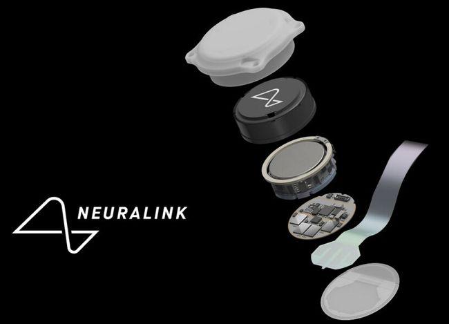 Neuralink планирует впервые имплантировать человеку зрительное устройство Blindsight уже до конца этого года