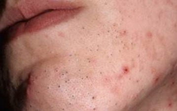 Черный волк