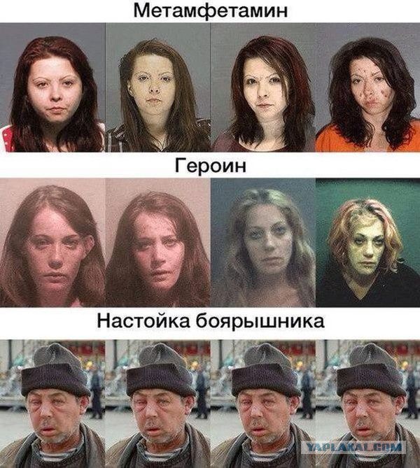 8 наших и зарубежных звезд, которые изуродовали себя пластикой