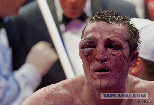 Боксёру Лебедеву запретили успокаивать буйного пассажира при перелёте из США