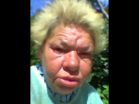 Испортить свою природную красоту за $120 тысяч