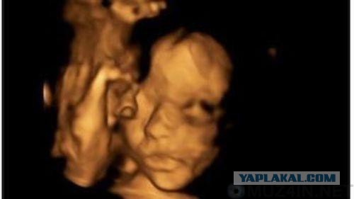 Шесть безумных хирургических операций, которые в действительности сработали