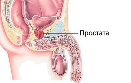 Простата хуже воровства