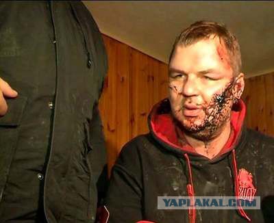 "Тайсон"прокусил ухо укропу.Партизаны во Львове :)