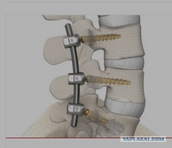 Починил клапан