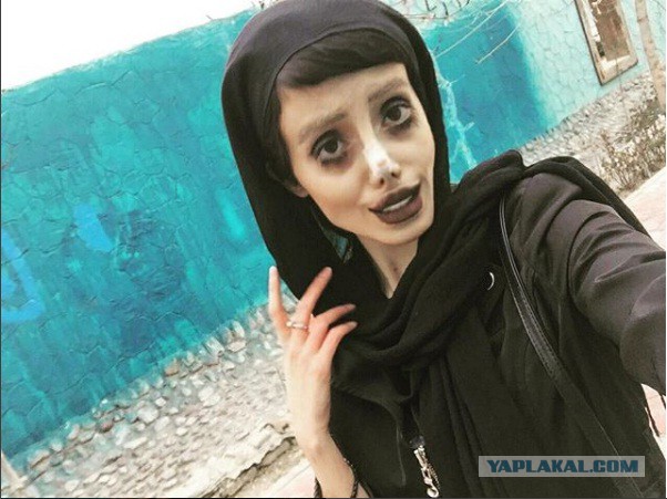Иранка сделала 50 операций, чтобы быть похожей на Анджелину Джоли