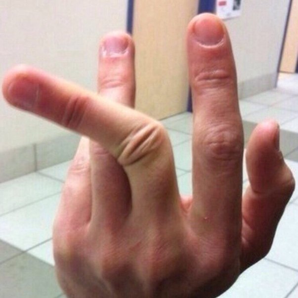 Лямблии кислая среда