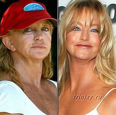 Знаменитости, которые безобразно стареют