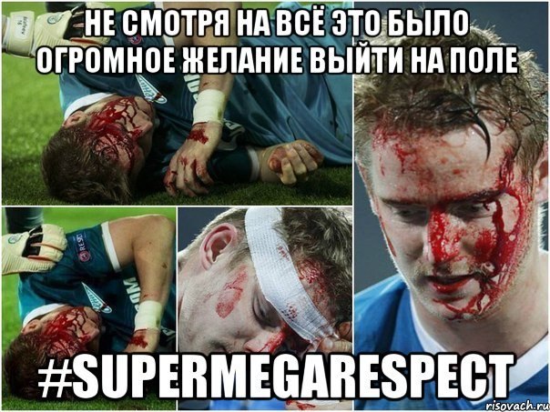 Просто вправил сустав во время игры