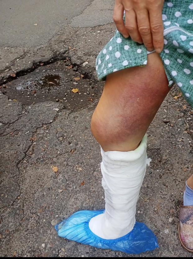 Склиф показал пациентов из Подмосковья, которых укусила гадюка